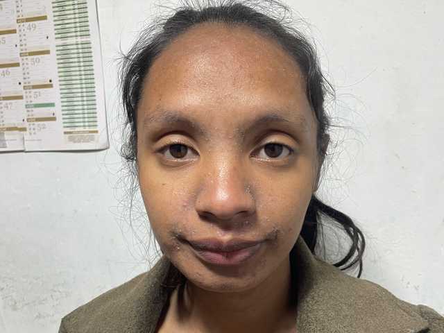 Fotografie profilu Mumul